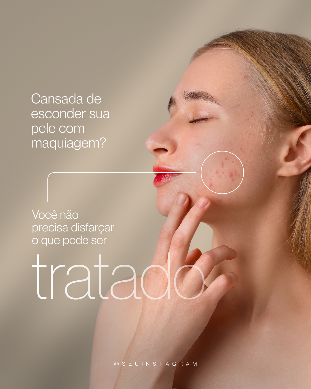 Arte para dermatologia: tratamento da pele